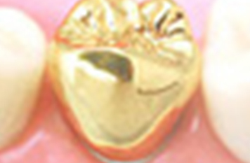 ゴールドクラウン